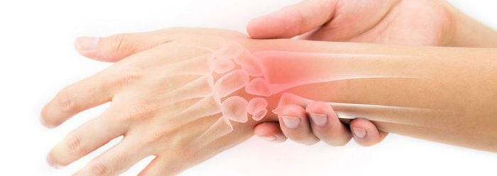 durere la încheietura mâinii și degetelor unguent pentru vindecarea ligamentelor la articulația genunchiului