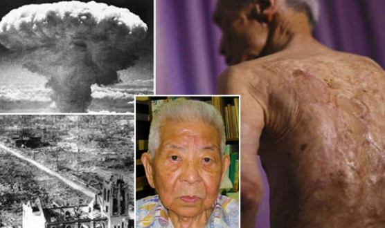 Supraviețuitor a două atacuri nucleare, Hiroshima și Nagasaki! Cel mai norocos om