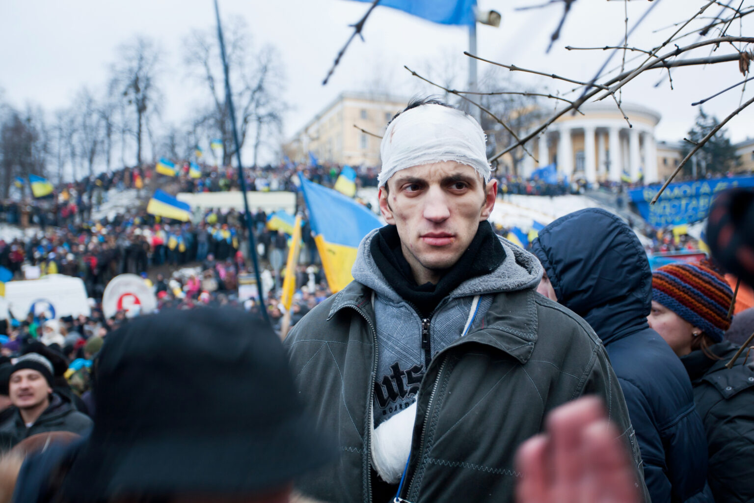 oameni-raniti-Ucraina-1536x1024.jpg